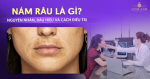 nám râu