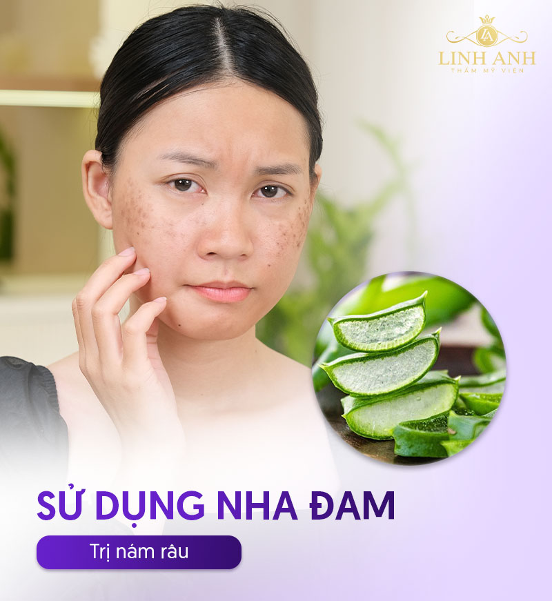 dùng nha đam trị nám râu