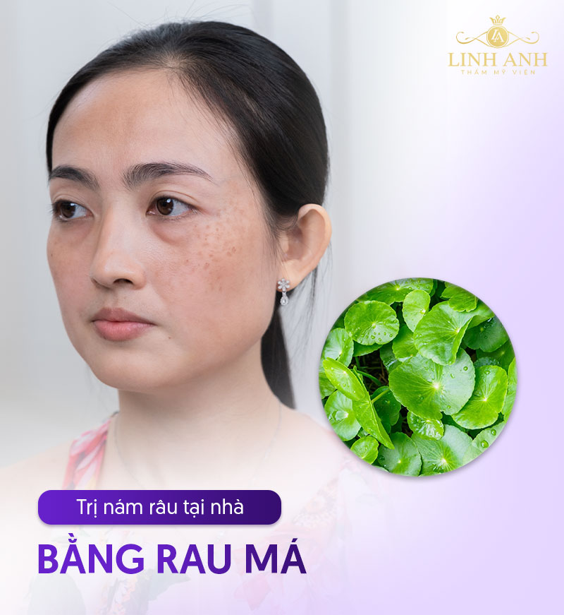 dùng rau má trị nám