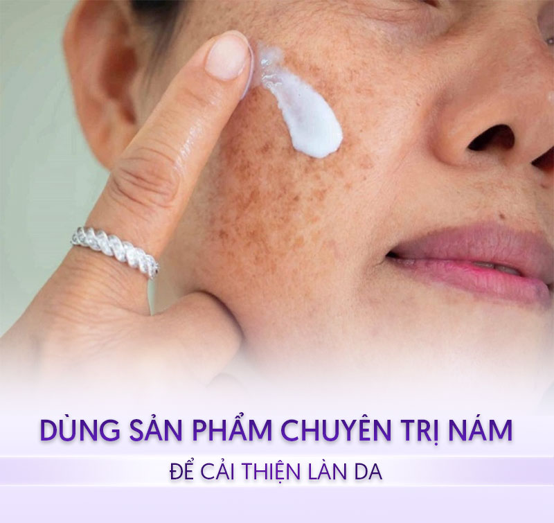 Sản phẩm chuyên trị nám sau sinh