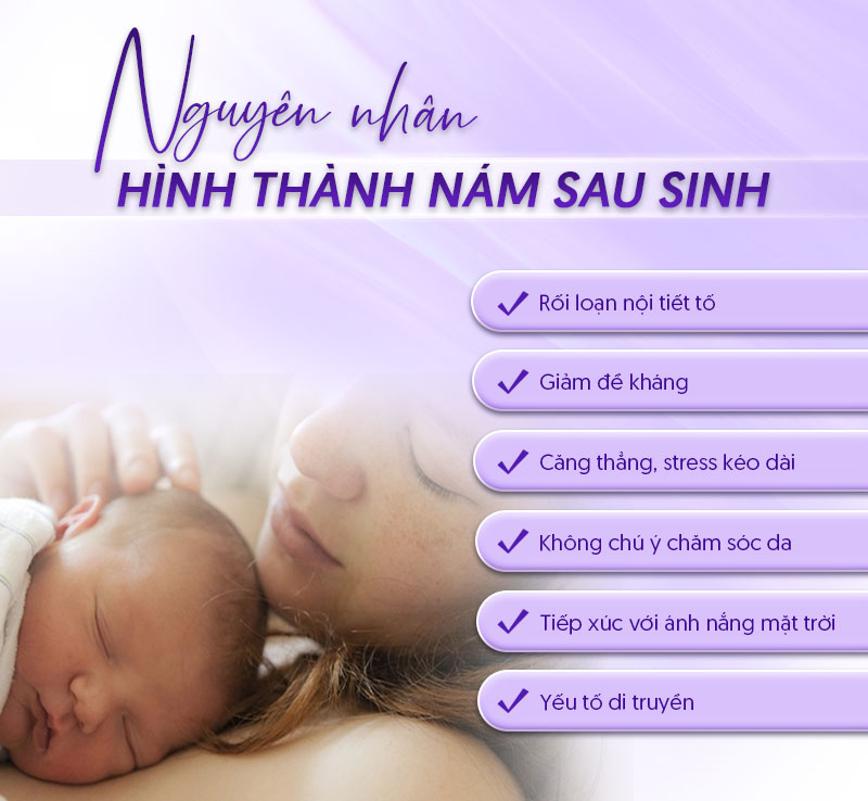 Nám da sau sinh do di truyền