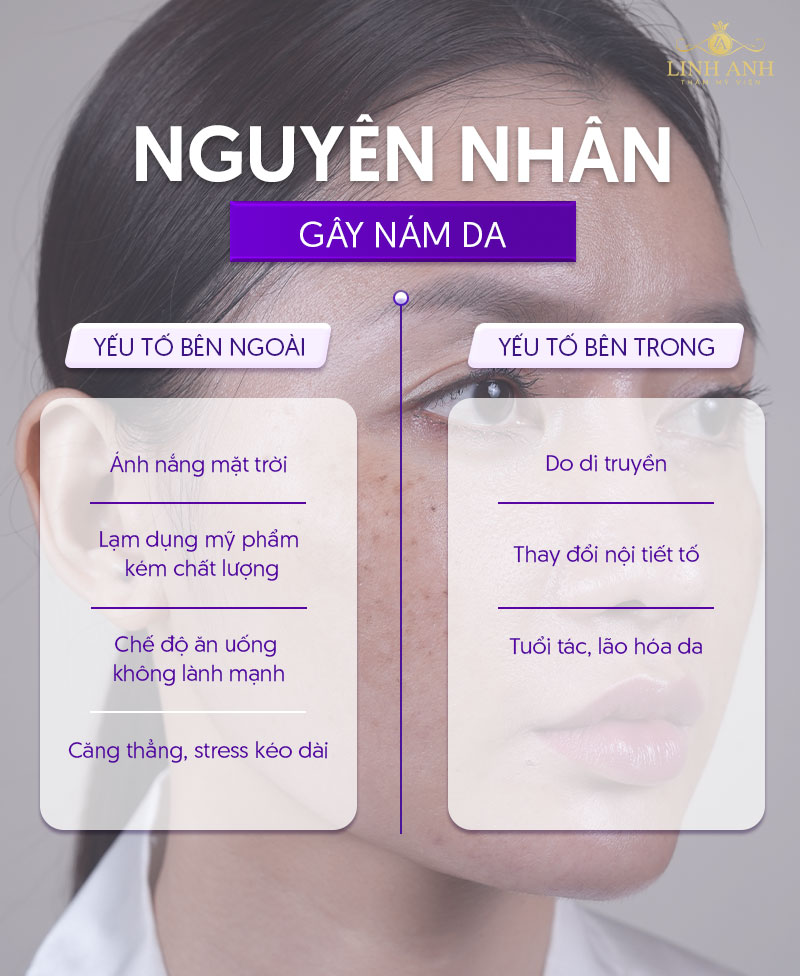 nguyên nhân gây nám da