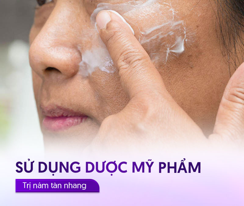 trị nám tàn nhang bằng dược mỹ phẩm