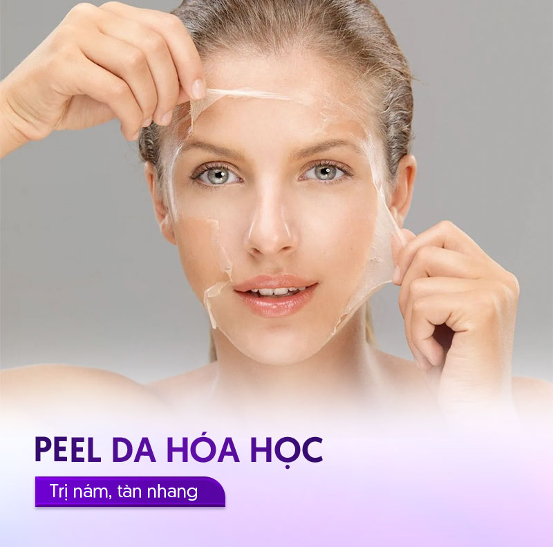 peel da hóa học trị nám tàn nhang
