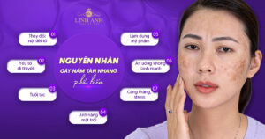 nguyên nhân gây nám tàn nhang