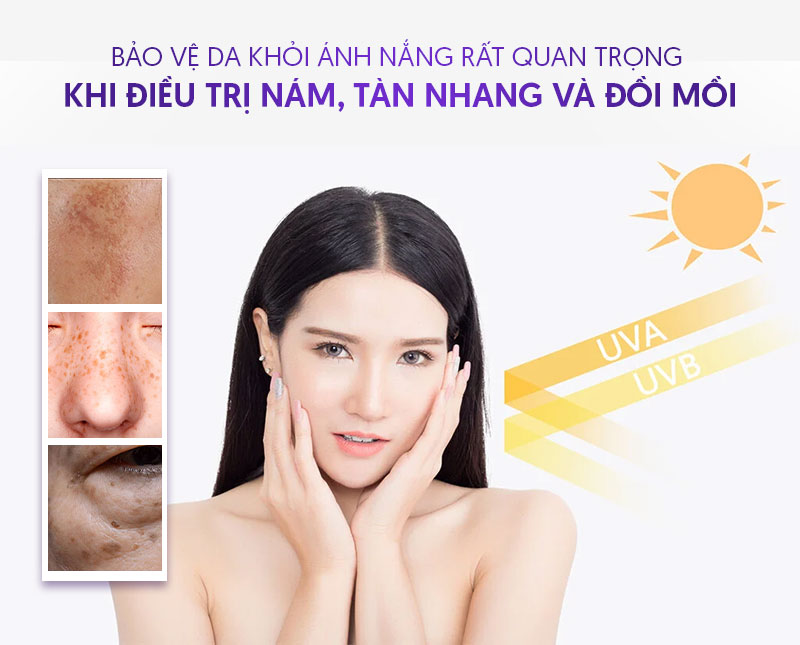 Bảo vệ da khỏi bị nám, tàn nhang