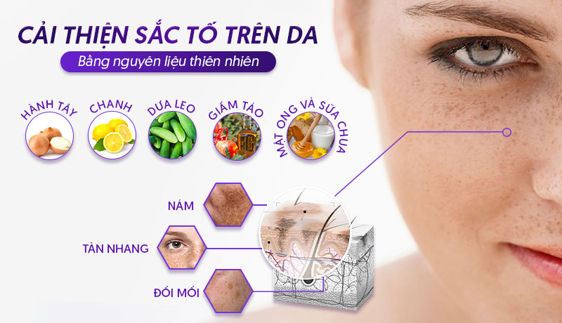 Cách trị tàn nhang đồi mồi trên mặt tại nhà
