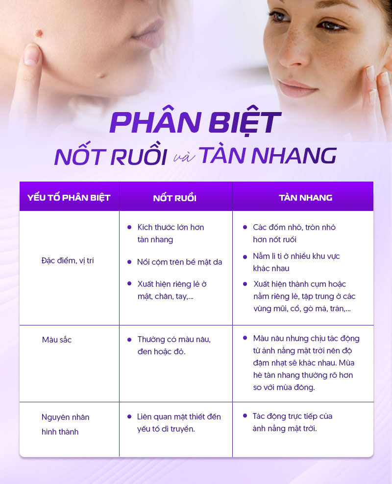 phân biệt tàn nhang-nốt ruồi