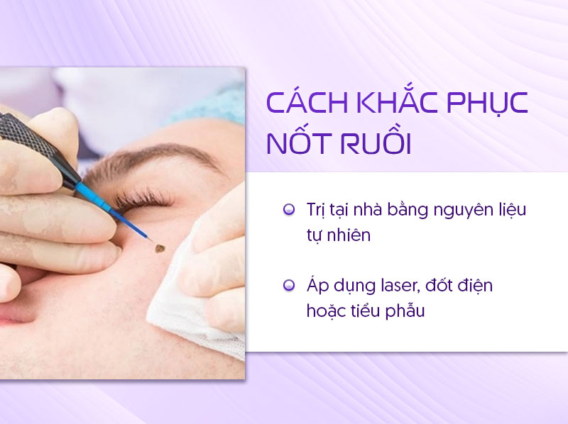 khắc phục nốt ruồi