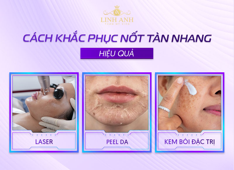 dùng công nghệ khắc phục tàn nhang