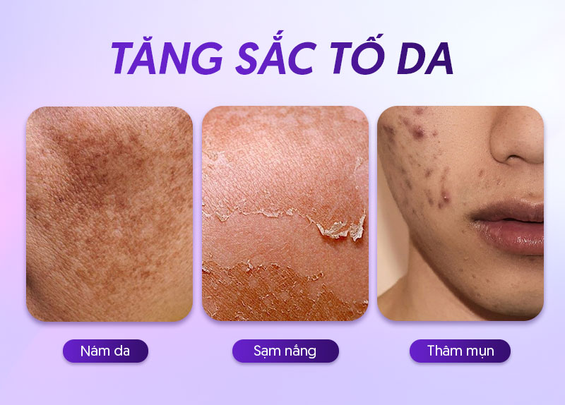 Tăng sắc tố da