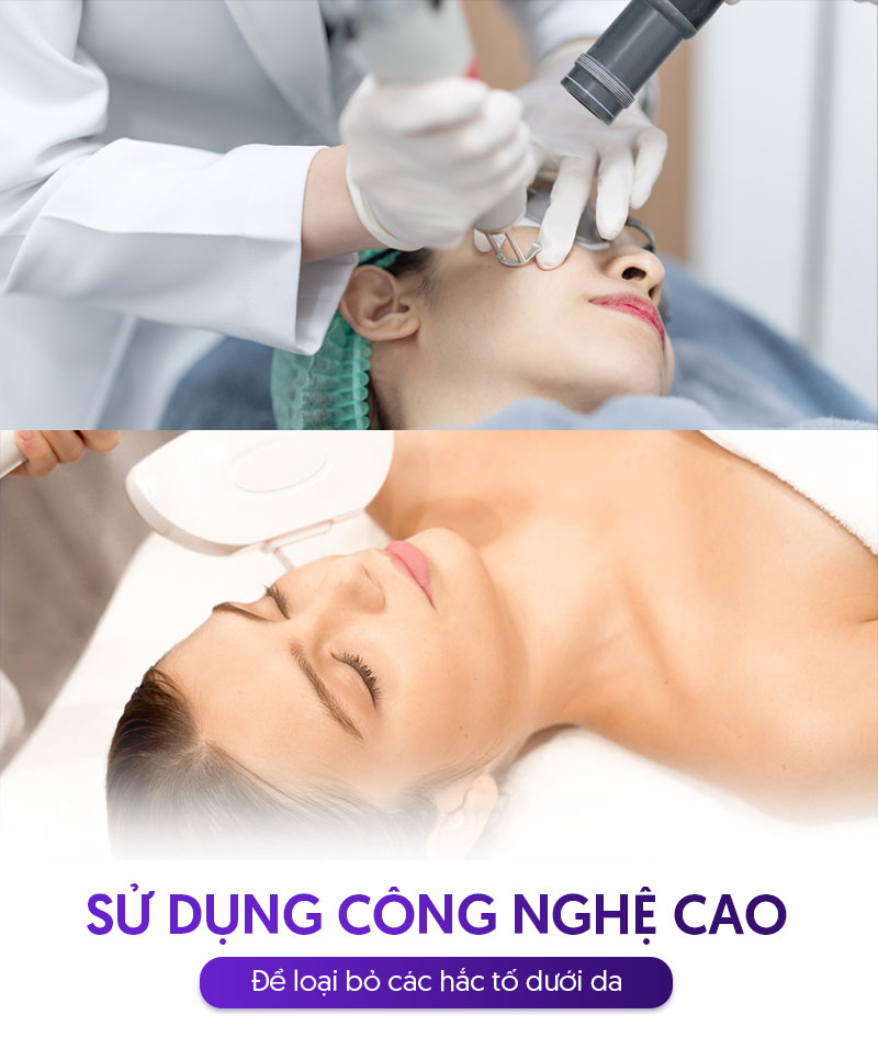 Trị rối loạn sắc tố da bằng công nghệ cao