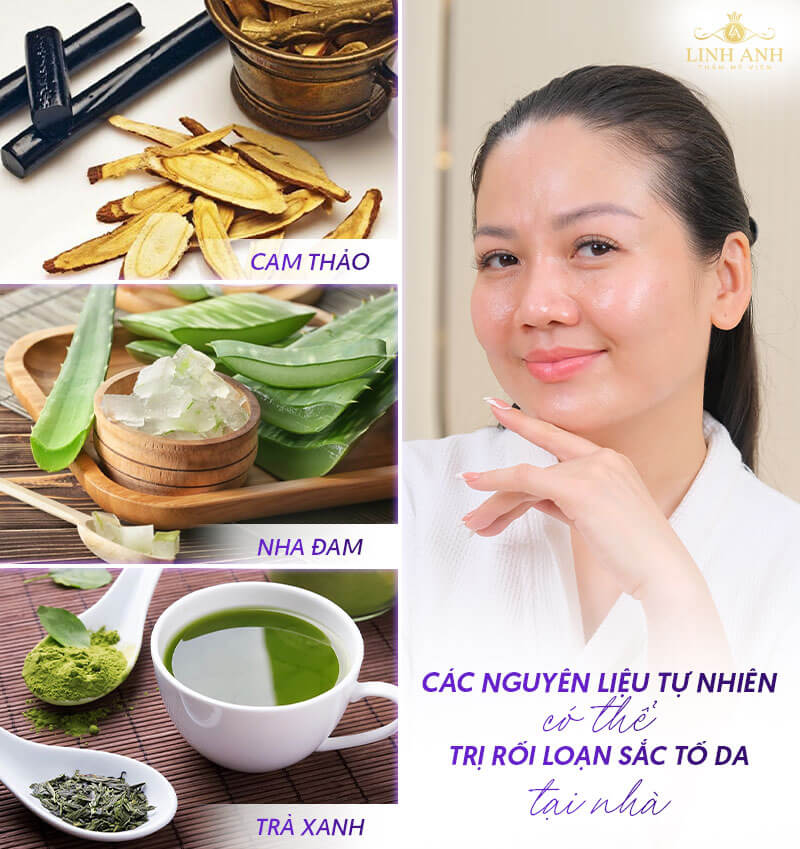 Điều trị rối loạn sắc tố da tại nhà