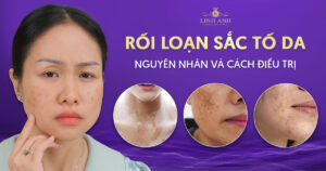 Rối loạn sắc tố da
