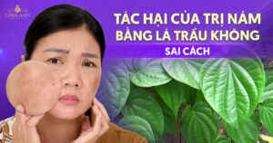 Tác hại của trị nám bằng lá trầu không sai cách