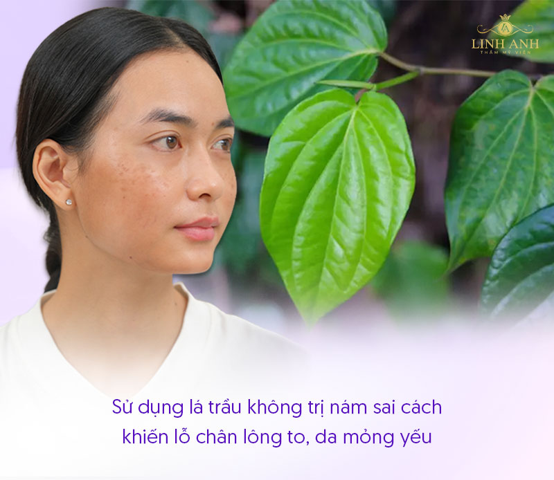 Lỗ chân lông to do trị nám bằng lá trầu không