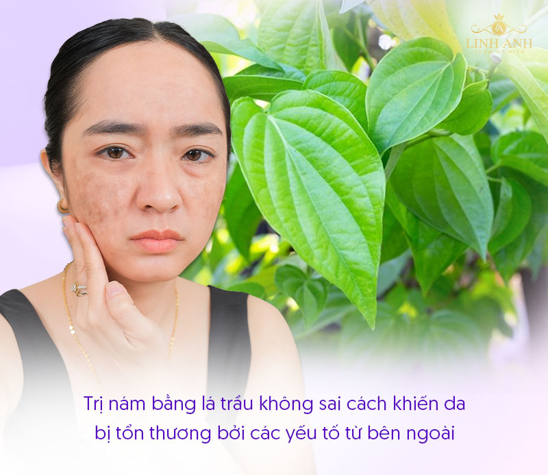Trị nám bằng lá trầu không làm da tổn thương