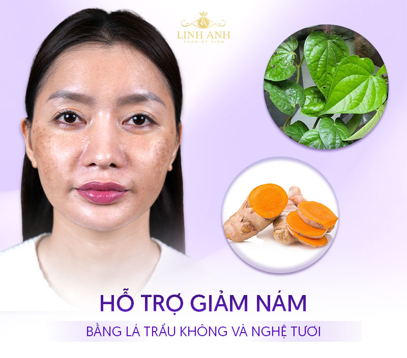 Dùng lá trầu không và nước cốt chanh trị nám