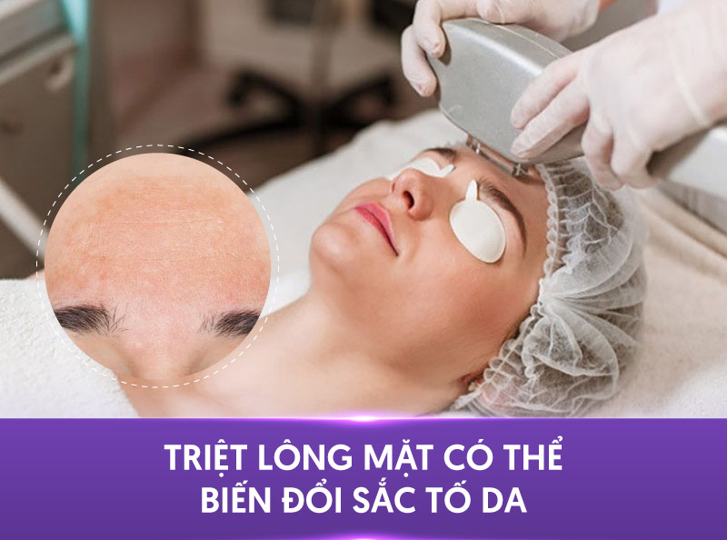 tác hại khi triệt lông mặt tác hại khi triệt lông mặt