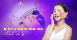 tại sao triệt lông mặt lại nổi mụn