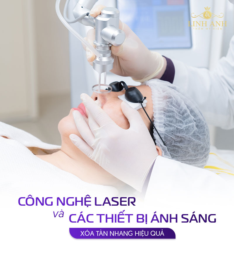 Mặt bị tàn nhang phải làm sao