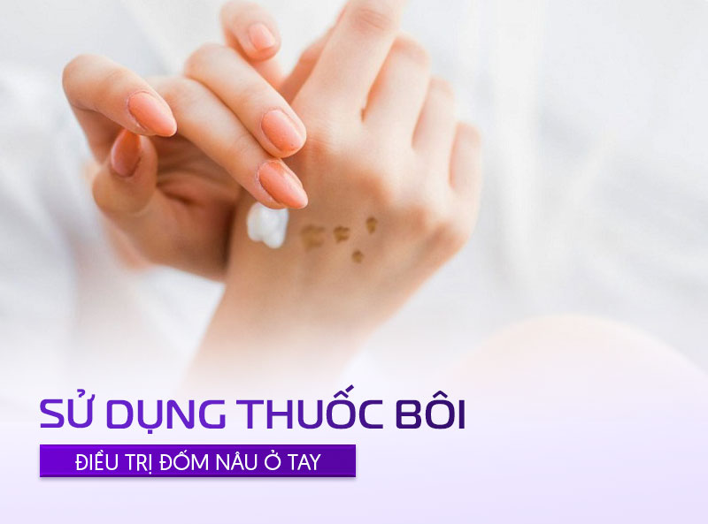 dùng thuốc bôi trị đốm nâu