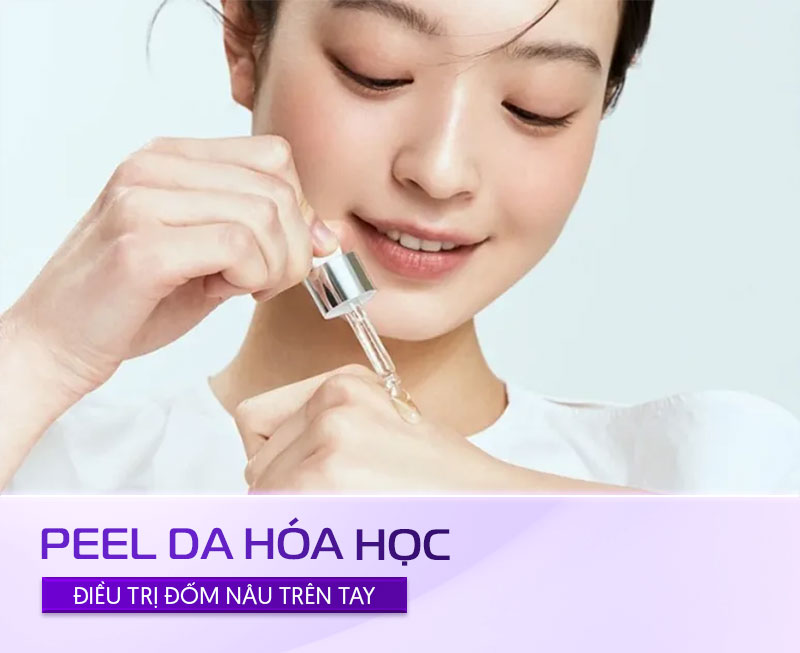 trị đốm nâu bằng cách peel da
