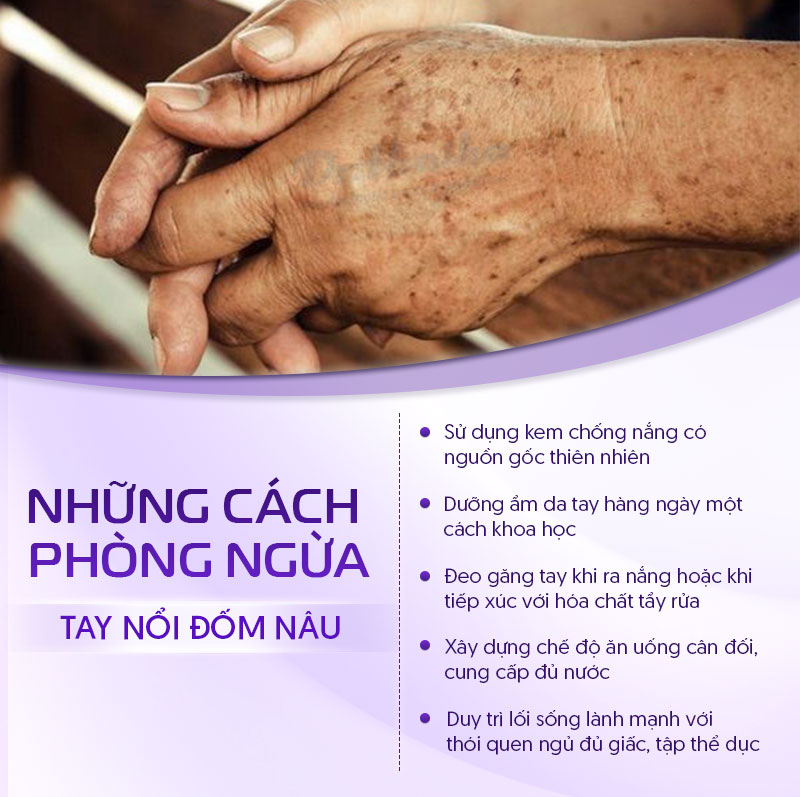 cách phòng ngừa đốm nâu