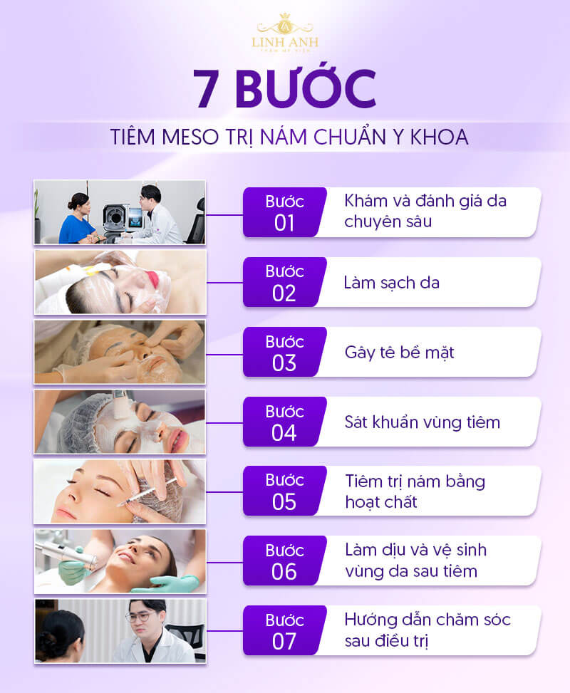 Các bước tiêm nám bằng meso
