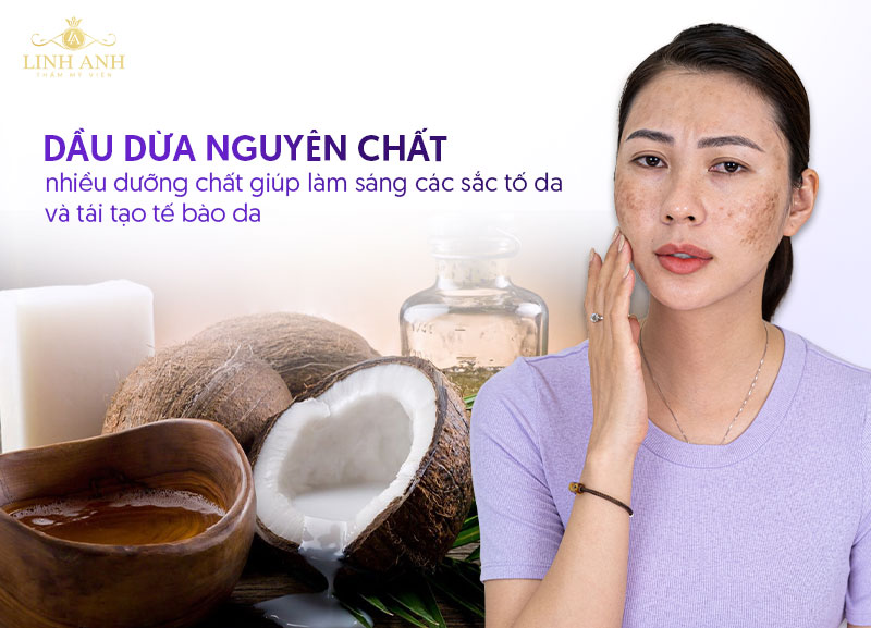 Dầu dừa có trị nám được không