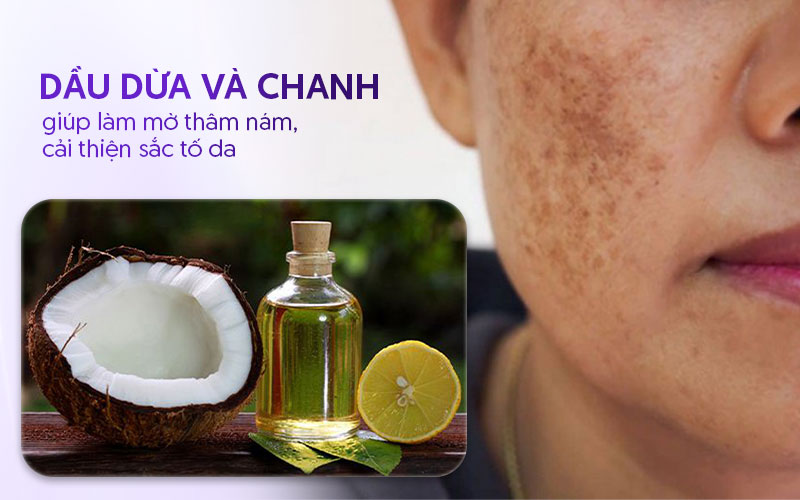 Cách dùng dầu dừa trị nám với chanh