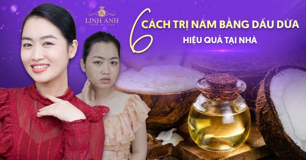 Trị nám bằng dầu dừa