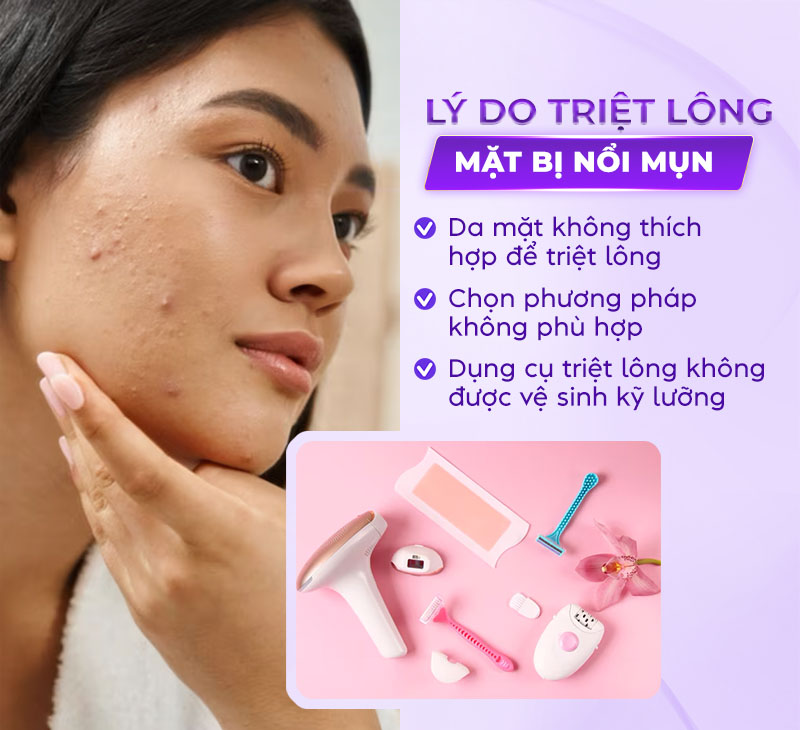 triệt lông mặt bị nổi mụn do đâu triệt lông mặt bị nổi mụn do đâu