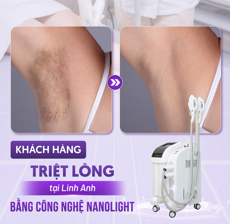 triệt long vĩnh viễn ở đâu triệt long vĩnh viễn ở đâu