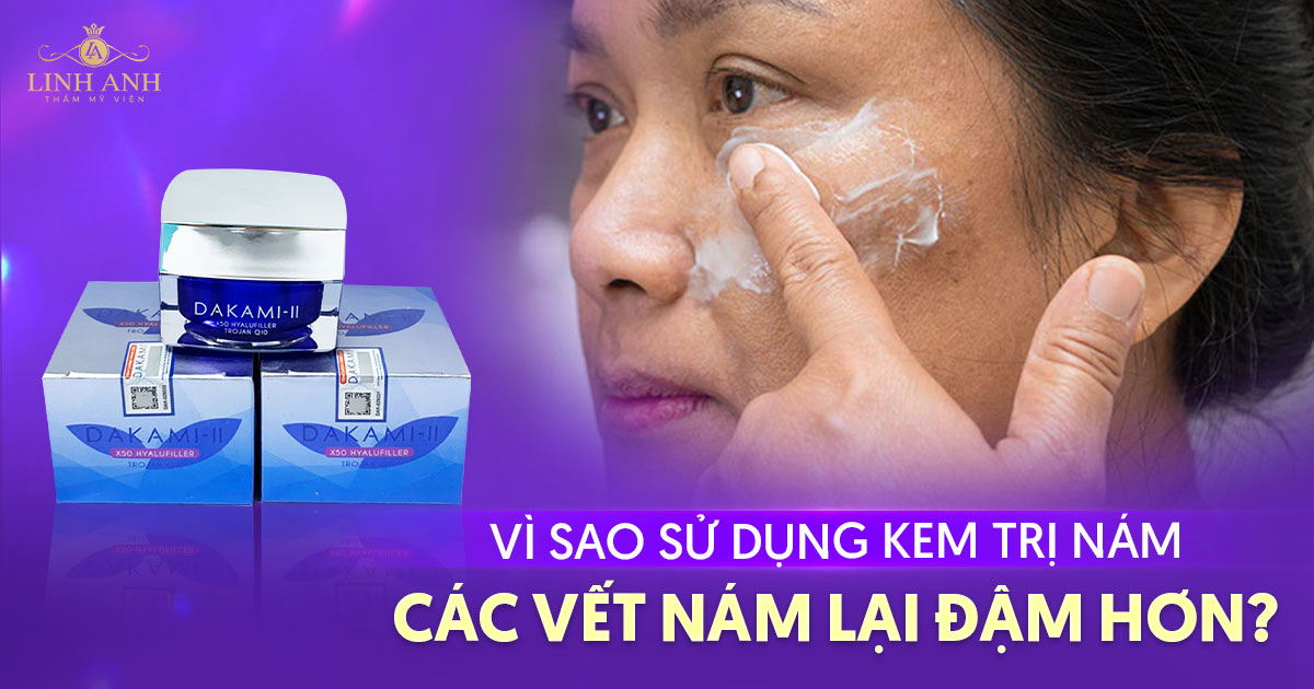 Vì sao dùng kem trị nám các vết nám lại đậm hơn? Lưu ý cần biết