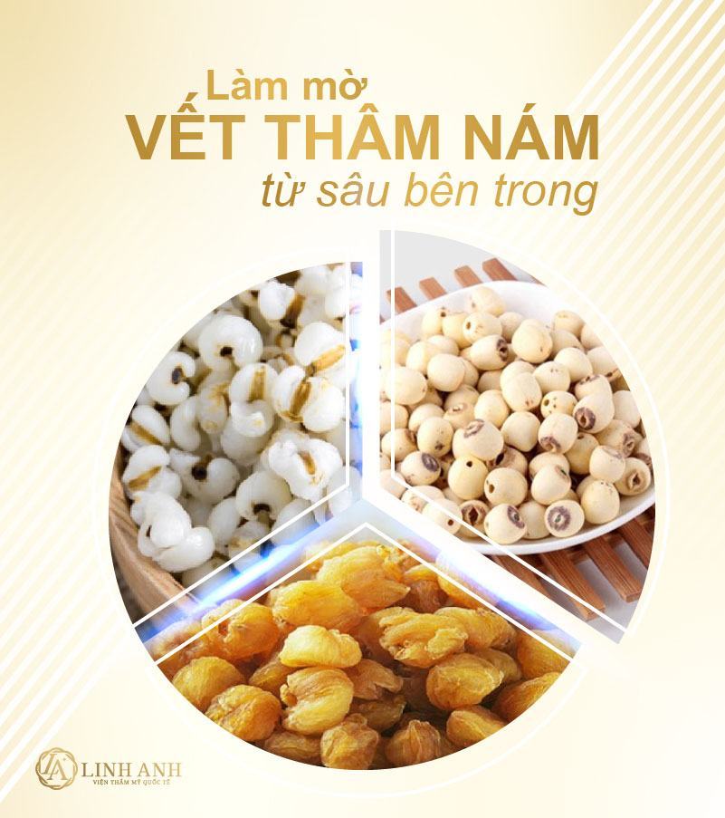 Điều trị nám bằng thuốc bắc Điều trị nám da bằng thuốc bắc - Viện thẩm mỹ quốc tế Linh Anh