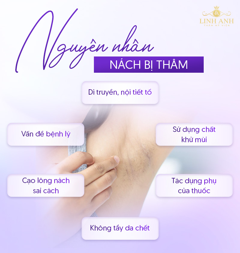 Sau triệt lông nách có hết thâm không Sau triệt lông nách có hết thâm không