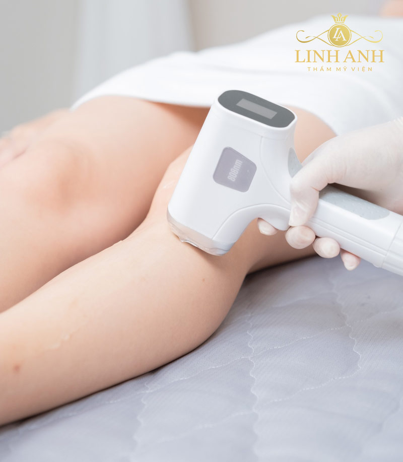 ảnh hưởng của lông chân với cơ thể ảnh hưởng của lông chân với cơ thể