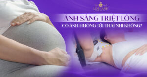 Ánh sáng triệt lông có ảnh hưởng tới thai nhi không
