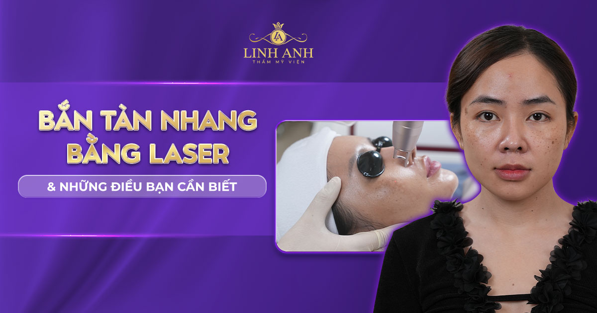 Bắn tàn nhang bằng laser và những điều bạn cần biết