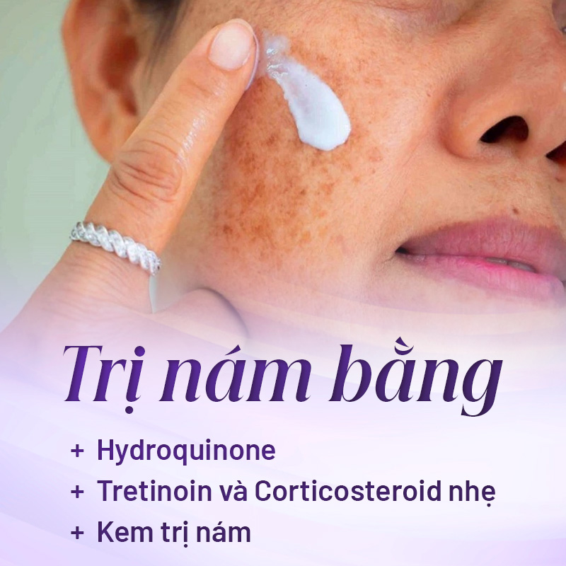 điều trị nám da bằng các sản phẩm bôi da trị nám