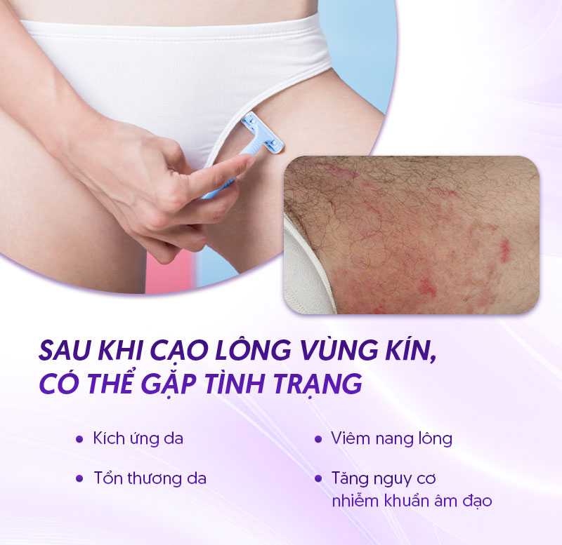bôi gì sau khi cạo long vùng kín bôi gì sau khi cạo long vùng kín