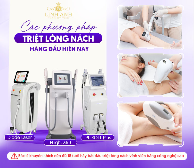 Các phương pháp triệt lông hiện đại Các phương pháp triệt lông hiện đại