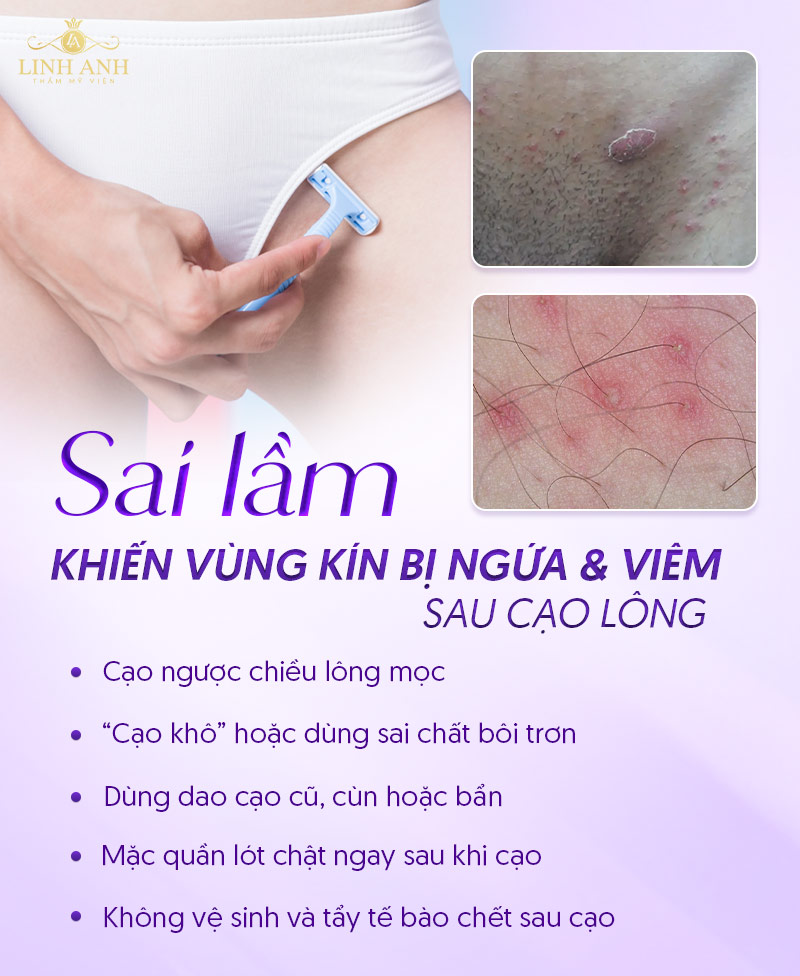 Cách cạo lông vùng kín cho nữ tại nhà