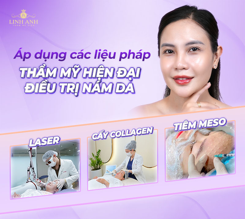điều trị nám da với công nghệ hiện đại