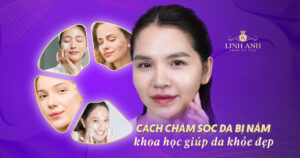 cách chăm sóc da bị nám