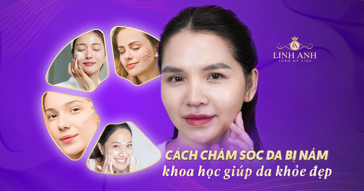 Cách chăm sóc da bị nám, tàn nhang khoa học, giúp da khỏe đẹp