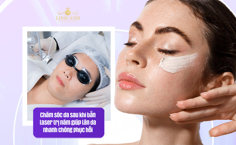 chăm sóc da sau khi bắn laser