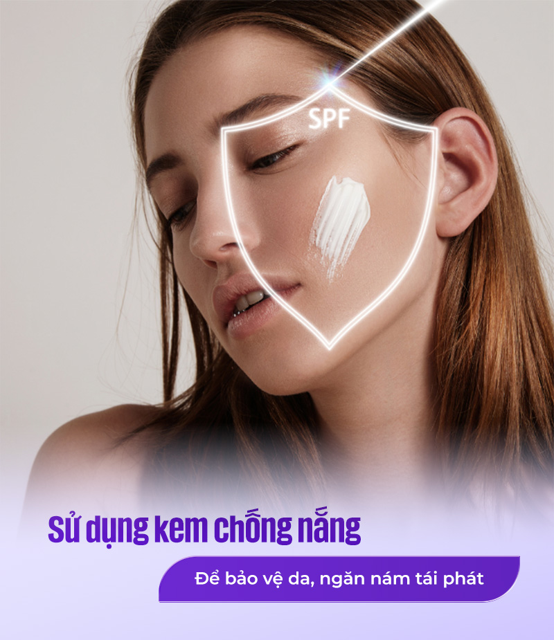 chống nắng kỹ sau laser trị nám