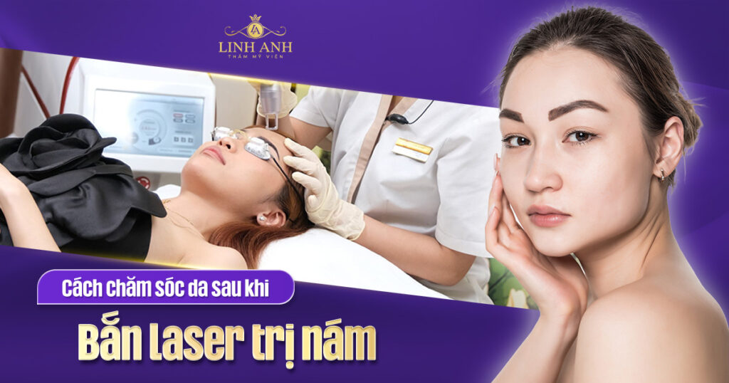cách chăm sóc da sau khi bắn laser trị nám